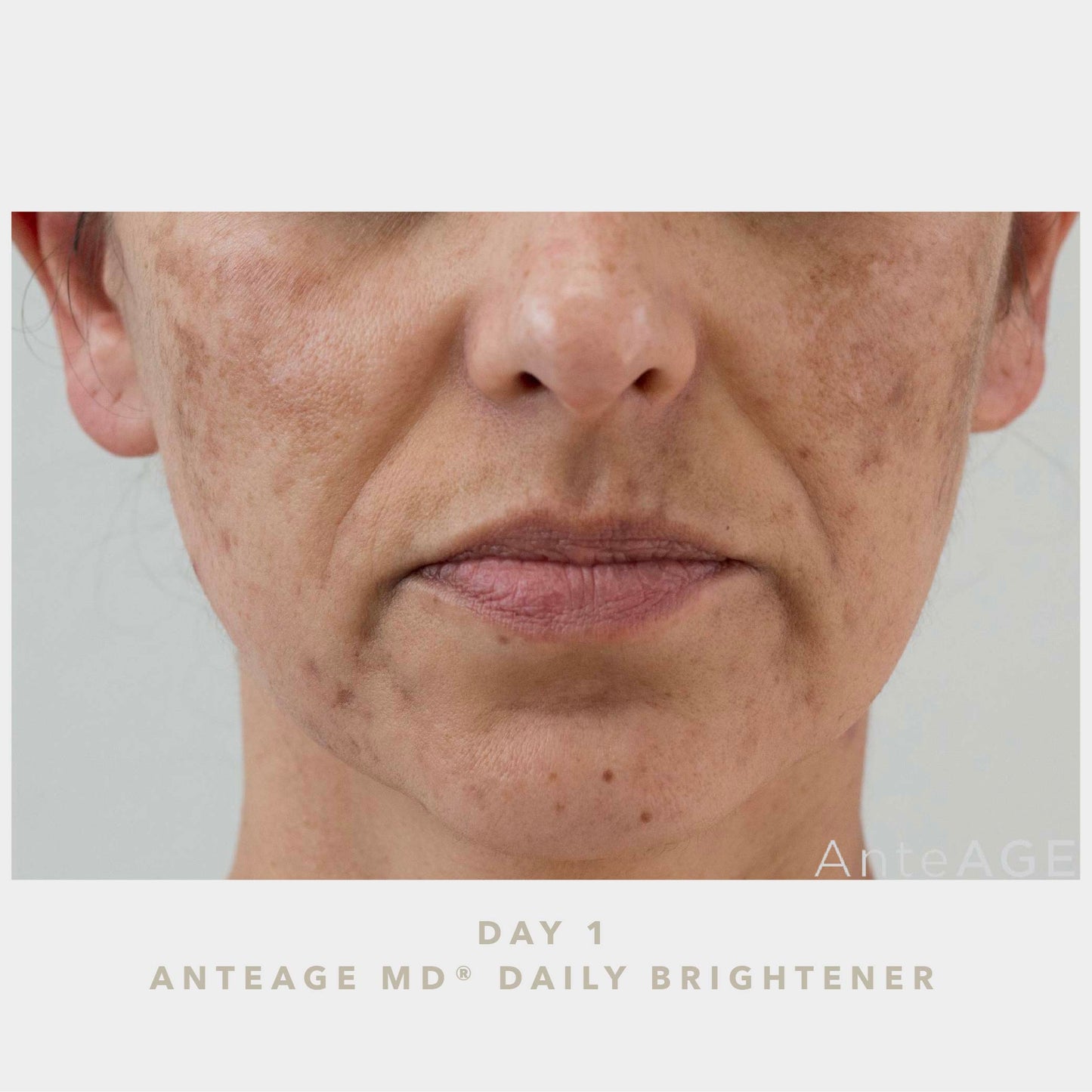 AnteAGE MD Brightener