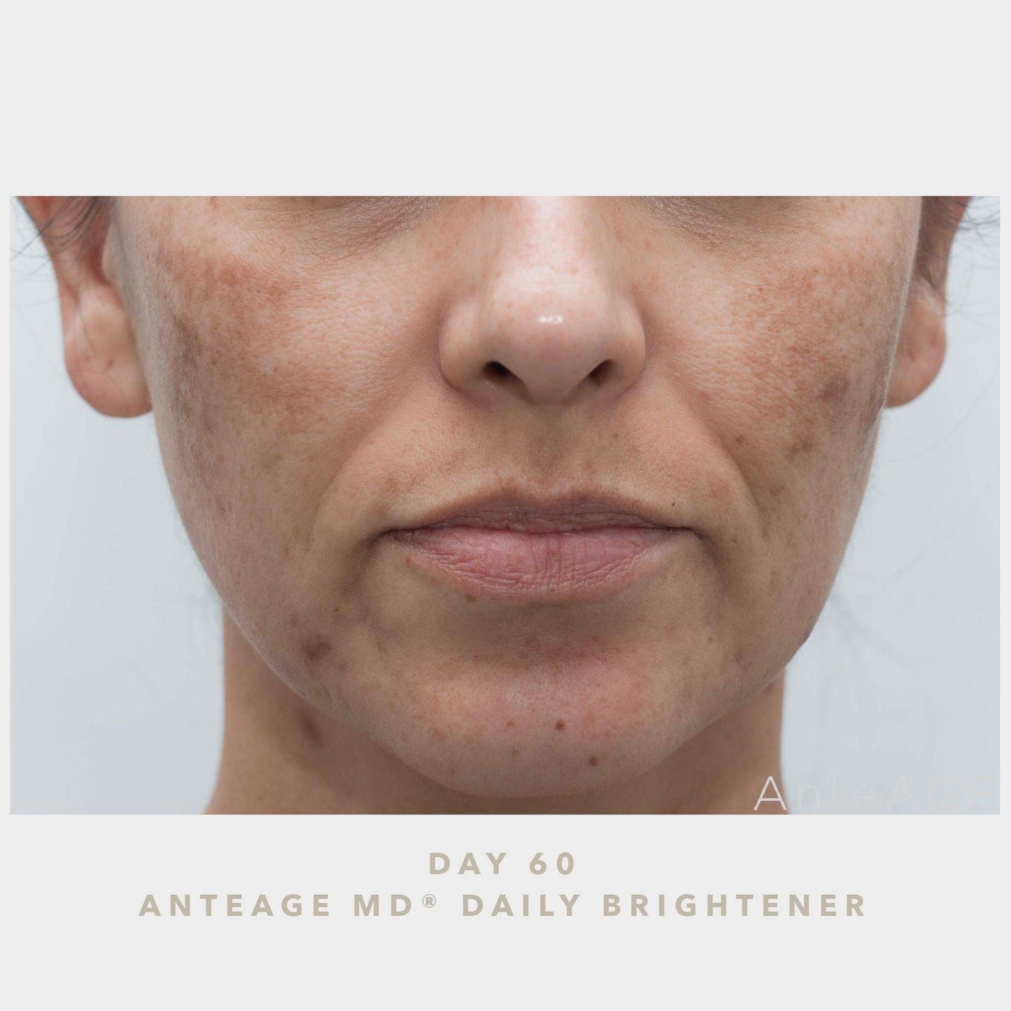 AnteAGE MD Brightener